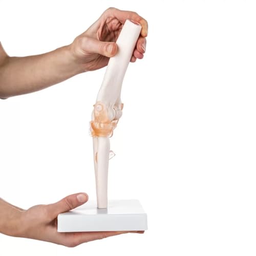 Image of Human Elbow Joint Model with Ligaments ✮ Scientific Life Size with Premium Display Base ✮ Best Teaching Tool for Patient Education & Anatomy Study
