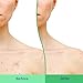Differin Body Scrub with Salicylic Acid Acne Clearing Improves Tone and Texture Prone Skin on Back Shoulders and Chest, 8 Oz (Packaging May Vary)