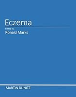 Eczema 1853170232 Book Cover