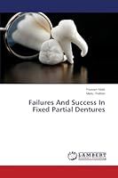 Failures And Success In Fixed Partial Dentures 3659640263 Book Cover