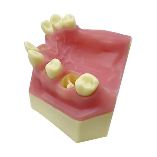 Modelo dental tipodonto para aprender restauración de sobredentaduras 4