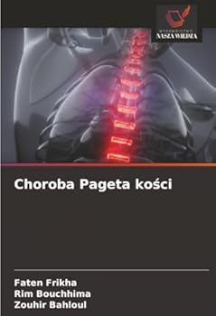 Paperback Choroba Pageta kości [Polish] Book