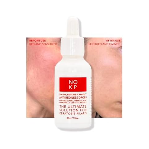 NO KP Anti-Redness Calming Serum Cover