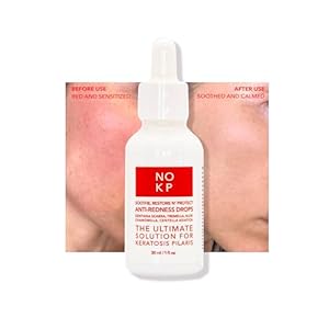 Anti-Redness Calming Serum for Face and Body, Relieves skin redness and Rosacea with Centella Asiatica (Tiger grass), aloe, panthenol