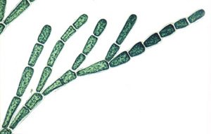 3B Scientific GmbH W13041 Algae Microscope Slides 30 Slides wt. Text, Grade: 1 to 2