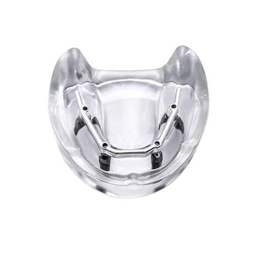 Implant Overdenture Model 4 Implants Silver Bar Implant Model Transparent Acrylic Mandibular Base Dental Teaching and Study Model