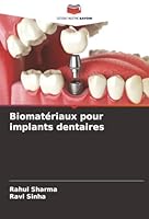 Biomatériaux pour implants dentaires (French Edition) 6208963028 Book Cover