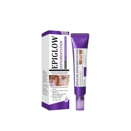 EPIGLOW MelanEX - Crema Antihiperpigmentación Avanzada Triple Acción, Antimanchas con Retinol Intensa para el Tratamiento de la Hiperpigmentación y Antiedad Facial