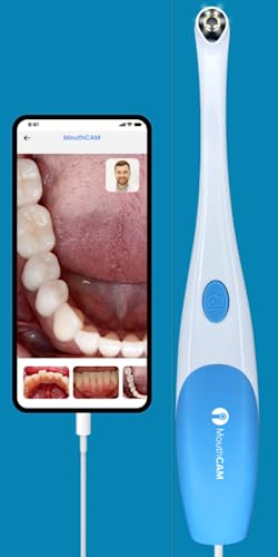 Mouthcam Intraoral Camera thumb #1