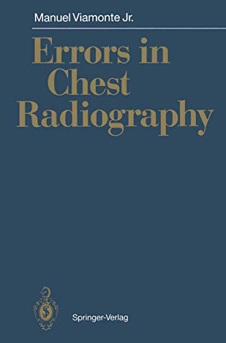 Errors in Chest Radiography view 2