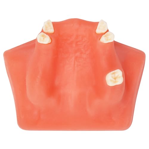 Ultrassist Dental Sinus Lifting & Implant Placement Practice Model B, Basic Implant Training Model with Practice Soft Gums, Great Dental Training Tooth for Dental Implant Practice