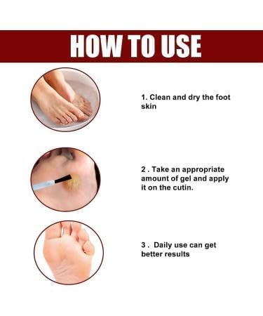 Image of Corn Ease Foot Eliminator Gel | Fast-Acting, Pain-Free Corn & Callus Remover | Gentle Formula for Soft, Smooth Feet | Effective Corn Treatment Gel for Men & Women | 30ml (3)
