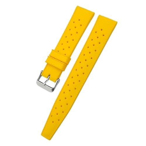 [���ł�] �g���s�b�N �V���R�� �N�C�b�N�����[�X ���o�[ �E�H�b�`�X�g���b�v �u���C�g�����O�Ή� �����W���Ή� �J���[���o�[�E�H�b�`�o���h(Yellow,22mm)