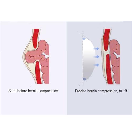 Faja para hernia inguinal con soporte ajustable tamaño Mediana miniatura 3