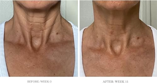 City Beauty Ultra-Firming Dry Oil - Neck & Décolletage Treatment - Hydrate & Lift - Solution for Crepey Skin, Sagging, & Wrinkles - Non-Greasy Formula - Anti-Aging Cruelty-Free Skin Care - Image 3