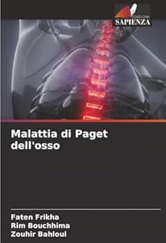 Paperback Malattia di Paget dell'osso [Italian] Book