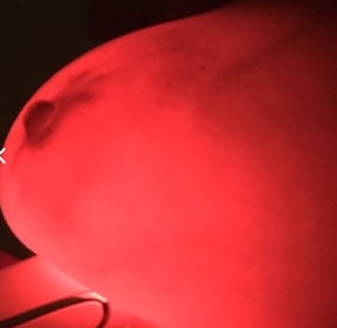 Équipement médical de diagnostic mammaire Luminous à LED rouge - 5
