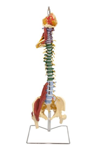 Anatomical Chart Co. - Muscle Spine with Disorders with Stand - -