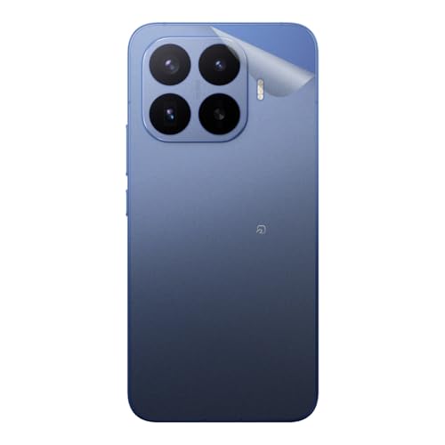 PDA�H�[ �X�L���V�[�� Xiaomi 17T Pro �Ή� �y�����E����K���X���z