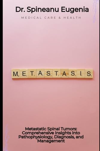 Metastatic Spinal Tumors: Comprehensive Insights into Pathophysiology, Diagnosis, and Management
