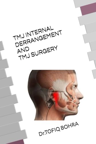 TMJ DISORDERS AND INTERNAL DERRANGEMENT: The most Ignored Disorder