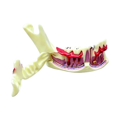 Modelo de anatomía de mandíbula desmontable y móvil para demostración médica 6