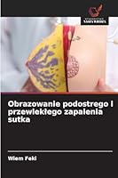 Obrazowanie podostrego i przewleklego zapalenia sutka 620927997X Book Cover