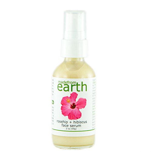 Rosehip Facial Serum - Calms Redness, Sensitive And Dry Skin, 2 Oz #TOP20