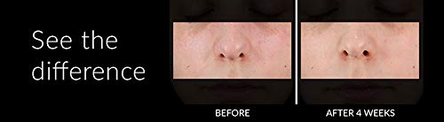 Clarisonic Sonic Face Exfoliator Cleansing Brush Head | Gentle Exfoliating Brush to Brighten Skin | Suitable for Sensitive Skin - Image 9