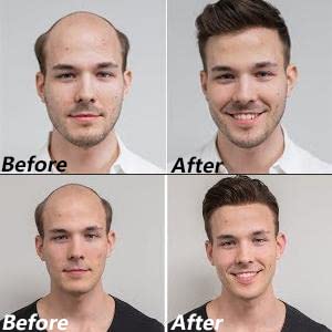 Miniatura 5 de Tupé de cabello humano para hombre, piel suave y fina (0.002 in), extensiones de nudo en V para hombres, 8 x 10 pulgadas, sistema de reemplazo de