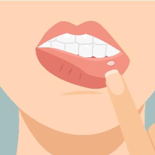 🔥 Solving the Mystery of Mouth Ulcers: Causes, Diagnosis & Treatments 🌿