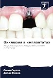Окклюзия в имплантатах: Раскрытие сокрытого: Разгадка тайн окклюзии имплантатов: Raskrytie sokrytogo: Razgadka tajn okklüzii implantatow