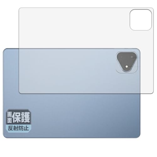 Leipsden ALLDOCUBE iPlay60 Pro (w) Ή ClearShield ی tB ˒ጸ hCA hw {