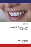Impacted Canine - An Overview