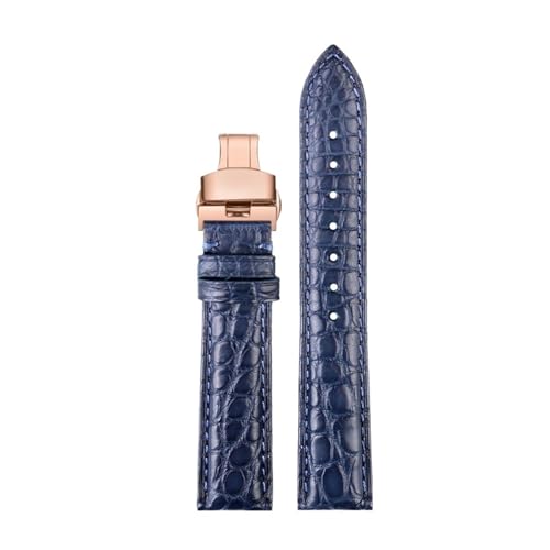 [-ł] JeBG YfB[X U[EHb`Xgbv L[}Xg h \ NR_CEHb`oh 16 18 19mm uXbgΉ(A-blue-rose gold,17mm)
