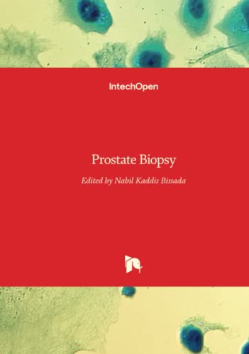 Prostate Biopsy view 2
