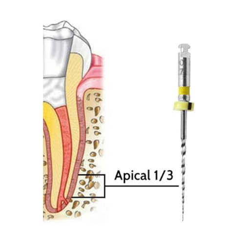 Retreatment Files to Remove Carrier Based Obturator, Gutta percha or Filling Paste 22mm (Pack of 6)