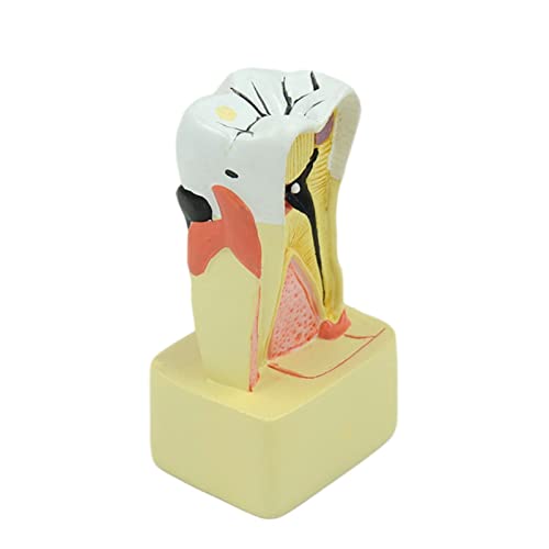 Dental Teeth Model Periodontal Model PVC for Dentist Teaching Student Study Medical Science