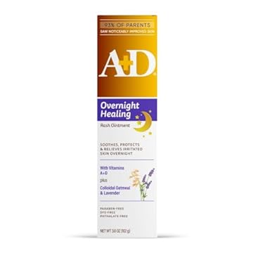 best heat rash ointment