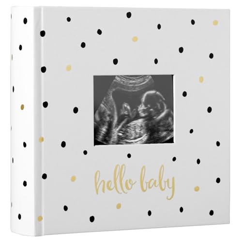 Pearhead Hello Baby Photo Album, Keepsake Book for New and Expecting Parents, Gender-Neutral Baby Accessory, Ideal Gift for Baby Shower, Holds 200 Pictures, Black and Gold Polka Dot by Pearhead - Used condition - US$11.24