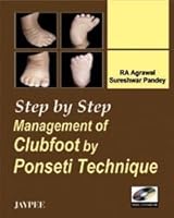Step by Step Management of Clubfoot by Ponseti Technique B01BJ4TQRS Book Cover