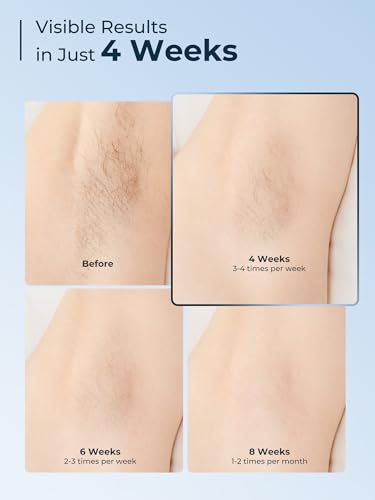 Aopvui IPL Hair Removal Device for Men and Women - Nearly Painless, Long-Lasting at-Home Solution with Ice-Cooling System and 999,999 Flashes