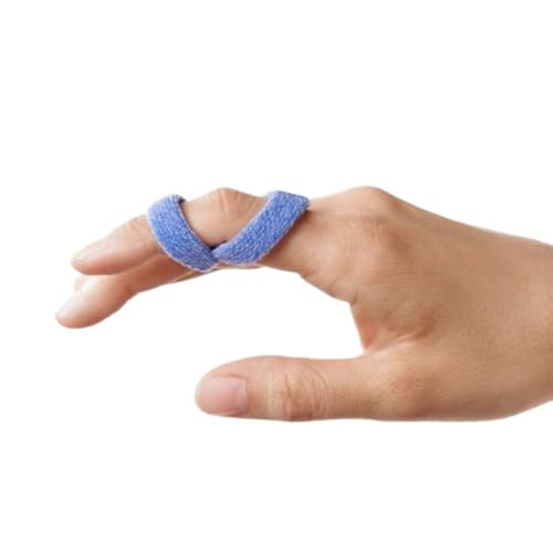 Orfit Orficast More Thermoplastic Tape, 2" X 9' (Blue)