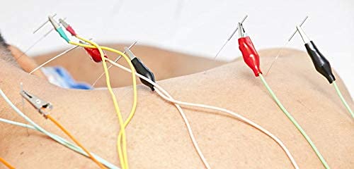 AHCP ACUPRESSURE HEALTH CARE PRODUCT Ahcp Electro Acupuncture Stimulator Therapy 6 Channel Acupuncture Machine AHCP ACUPRESSURE HEALTH CARE PRODUCT Ahcp Electro Acupuncture Stimulator Therapy 6 Channel Acupuncture Machine