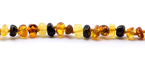 Primoyo Set collana e bracciale in ambra baltica