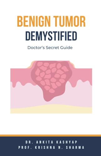Benign Tumor Demystified: Doctor's Secret Guide
