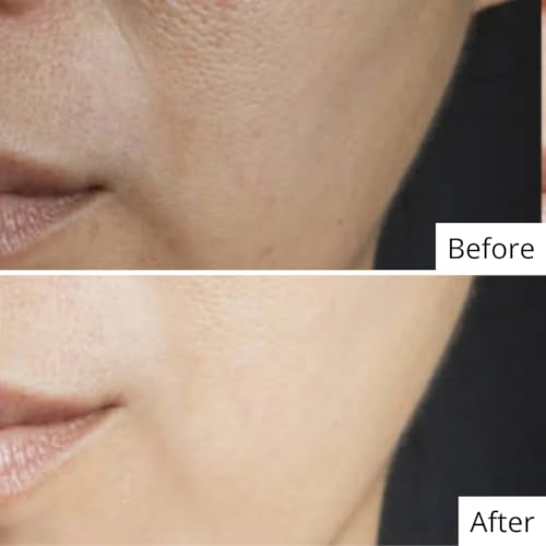 Image of Glow Boosting Niacinamide Face Serum with Alpha Arbutin for Dull Skin | Dark Spots Removal Serum for Glowing Skin | Hydrating, Vegan & Dermatologically Tested | 9ml