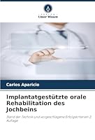 Implantatgestützte orale Rehabilitation des Jochbeins (German Edition) 6202325585 Book Cover