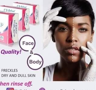 CY Gabriel Skin Whitening Soap Kojic Soap With Glutathione 135g :  Amazon.co.uk: Beauty