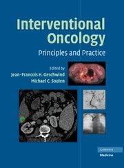 Interventional Oncology: Principles and Practice book cover